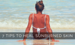 7 Tips to Fix Sunburned Peeling Skin