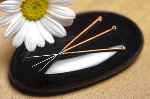 Acupuncture and Traditional Chinese Medicine